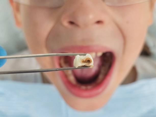 Best Emergency Denture Repair in Buchanan, VA